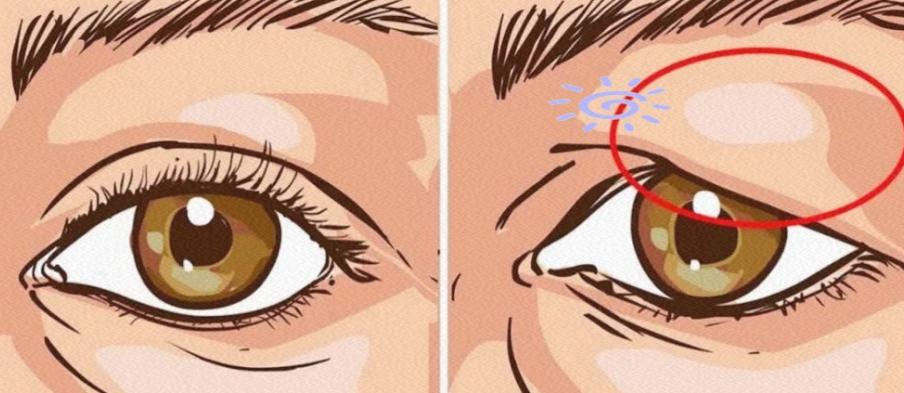 成都李波提眉手术2025年12月价格:真实测评来了,1.5万左右,术后成效分享 成都李波医生做提眉怎么样?本地姐妹的真实反馈参考