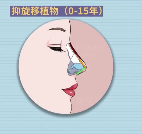 深圳鼻修复李晓平博士：患者选择他的3个核心原因www.236z.com