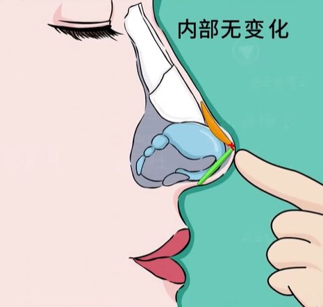 深圳鼻修复李博士怎么联系预约？李晓平挂号+面诊全流程解析，让