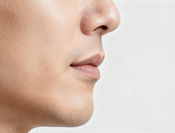 成都人中缩短术王皓民预约流程全解析!线上挂号+面诊1次搞定 成都人中缩短术王皓民预约前需明确的医生与项目信息