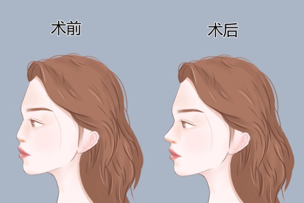 哈尔滨宋明亮整形医生价格合理吗?粉丝反馈:项目明码标价,不坑人 哈尔滨宋明亮整形医生价格合理