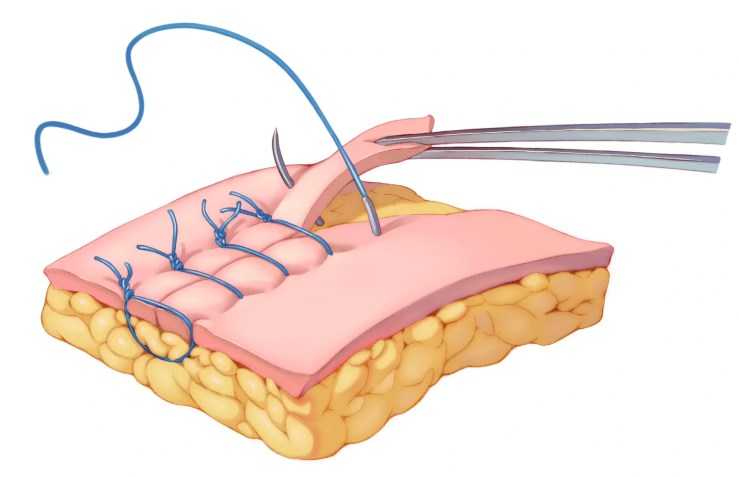 四、梁晓健与其他深圳隆鼻医生对比
