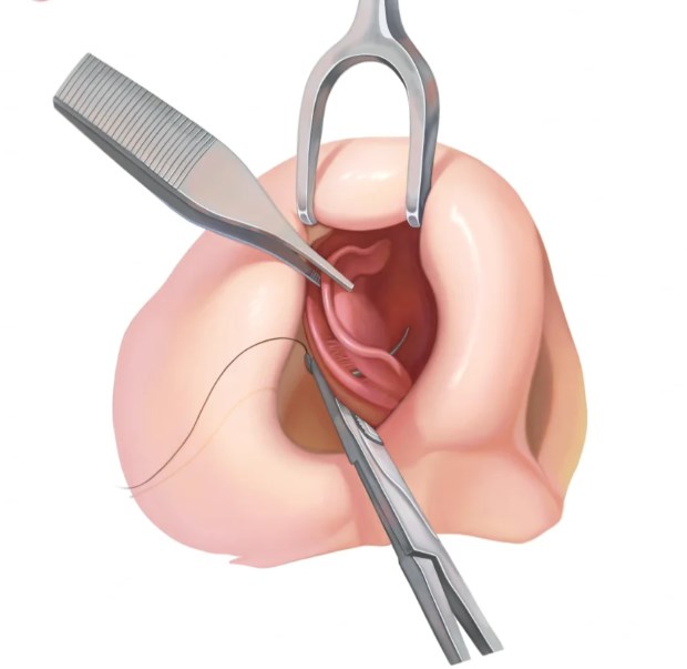 三、梁晓健医生就诊全流程指南