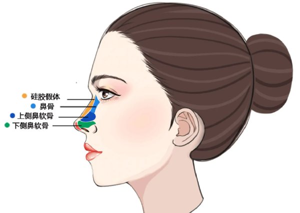 李战强和梁晓健谁做鼻子做得好?李战强精于高难鼻修复,梁晓健擅打自然动态鼻,风格不同都高端! 一、李战强和梁晓健谁做鼻子做得好?各有专攻!水平较高实力适配不同需求www.236z.com